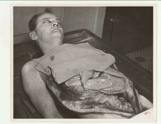 Cadaver Medical Autopsy Photo Pathology Crime Coroner Morgue Corpse Macabre