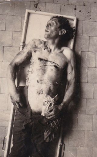 Silver Photograph Dead Man Morgue 1940s Tripod Angle? Post Mortem