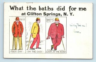 Clifton Springs,  Ny - Rare C1914 Baths Advertising Comic Postcard - T1