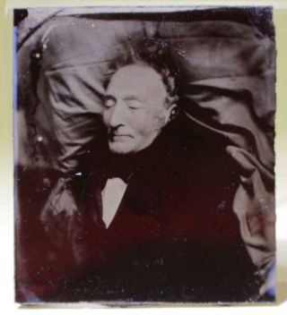 1861 St.  Louis Dr.  Louis Vitalis In Casket Post Mortem Ambrotype W/case