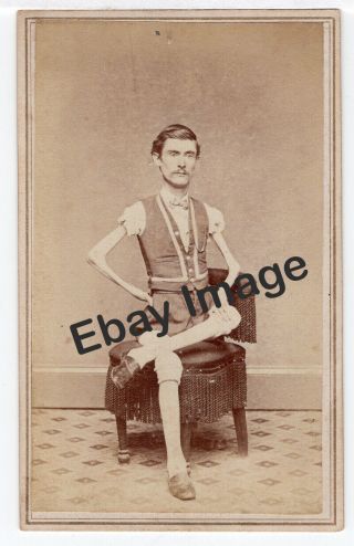 Isaac Sprague The Thin Man 1865 - 1868 P.  T.  Barnum Circus Cdv