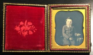 Boy With Cleft Palate 1/6th Plate Daguerreotype In Leather Case Seals