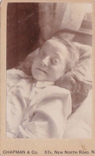 Vintage Carte De Visite 1880s England Very Sick Child Death Bed Post Mortem Int