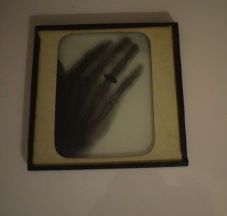 ANTIQUE Magic Lantern Slide XRAY OR SHADOWGRAM OF HAND WITH RING C1900 PHOTO 2