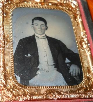 1/6th Plate Ambrotype Handsome Young Man In Half Case
