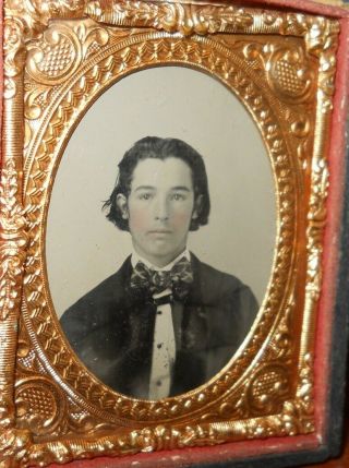 1/9th Plate Ambrotype Of A Young Man In Half Case