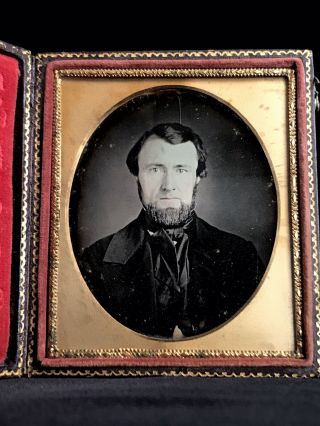 1/6 Plate Daguerreotype - Close - Up Of Gentleman W/ Tinted Face In Full Case