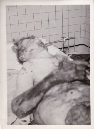 Vintage Silver Photo 1940s Dead Man In Morgue Abstract Post Mortem