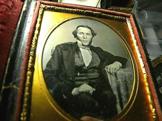 1/6 Plate Daguerreotype - Man With Multiple Sclerosis