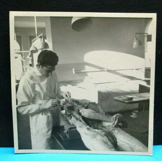 Vintage 1952 Autopsy Anatomy University Medical Student 10x10 Cm Photo