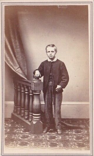 Carte De Visite Cdv Vintage 1860s C.  E.  Child With Black Eye