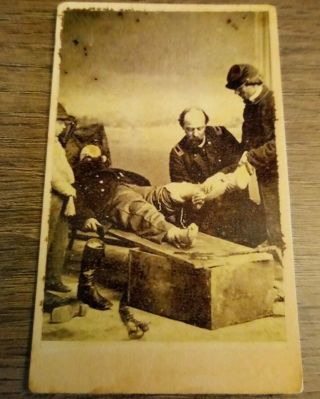 Civil War Cdv Of A Surgeon Amputing A Soldiers Leg Reprint On Period Card