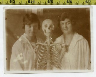 Vintage 1927 Human Skeleton Photo / Medical Student Girlfriends W Bony Boyfriend