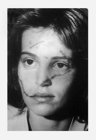 1986 Nypd Crime Victim Three Vintage Photographs