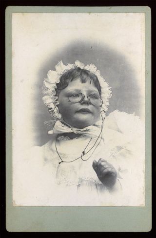Antique 19th Century Cabinet Photo Child In Pince - Nez Glasses Spectacles/bonnet