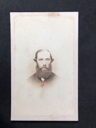 Victorian Carte De Visite Cdv: Unusual Man: Jewish Styled Hair Hand Painted Rose