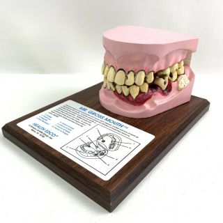 Mr.  Gross Mouth Tobacco Classroom Educational Mouth Model Dental Health Edco