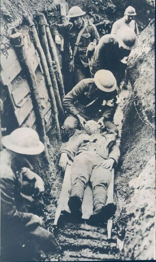 1939 Press Photo Military Ww2 Era Mercy Shellhole Trench Muddy Crippled 8x10