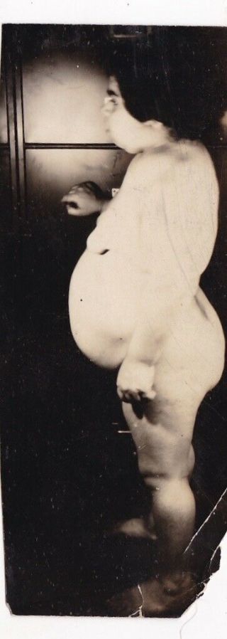 Vintage Silver Snapshot Photo Unusual Creepy Medical America 1930