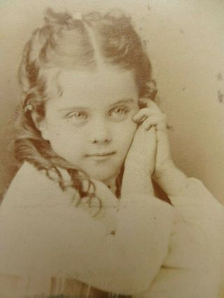 Antique Cdv Cabinet Photo Lovely Little Girl Big Eyes Hand To Cheek Chicago Il
