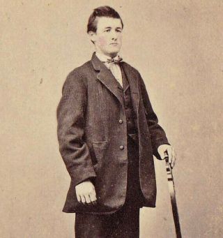 Young Man W/ Rosy Cheeks - 1860s Cdv Photo W/ Civil War Revenue Stamp