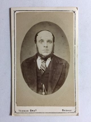 Victorian Carte De Visite Cdv Photo - Gentleman - Yeoman Bros - Bedale