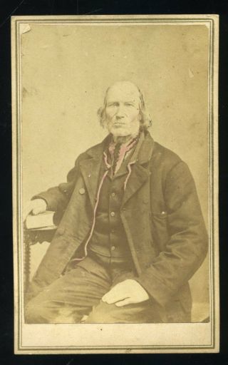 Civil War Era Cdv Photo Of Bald Man Great Period Clothing