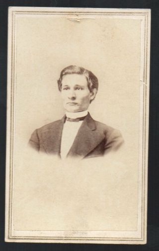 Cwe Cdv Photo Of Man Great Hair & Clothing By Moore Bros Of Springfield Ma