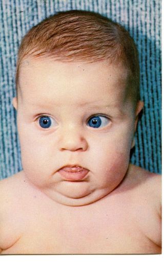 Chubby Baby - Must Be Something I Ate - Funny Face - Cute Comic Vintage Postcard