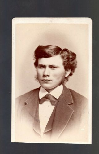 Cdv Photo Of Man That Looks Out Of Place For The Time Great Hair And Suit