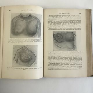 Antique Vintage Medical Book 1930 A Textbook Of Surgery Illustrated Medicine