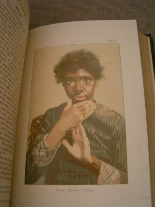 Diseases Of The Skin 1892 John V.  Shoemaker Antique Medical Book W/color Plates