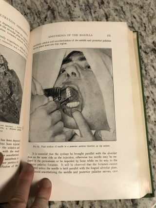 1956 Antique Medical Book " General Anesthesia In Dentistry "