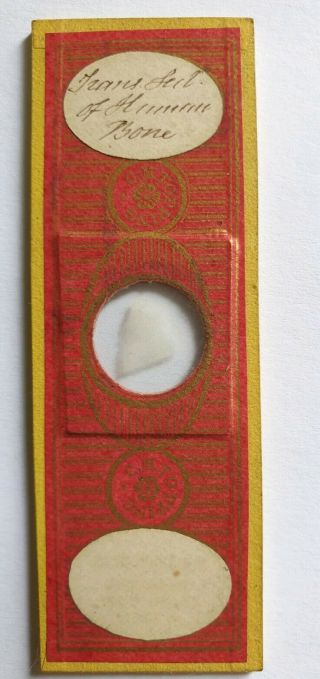 Fine Antique Microscope Slide " Tran.  Section Of Human Bone " By C.  M.  Topping