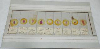 9 X Antique Vintage Pathology Microscope Slides (t)