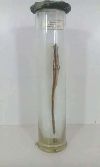 Vintage Worm Wet Specimen Taxidermy Biology Autopsy