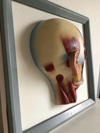 Rare Vintage LifeSize Anatomical Head Medical Model Art French 3D - Wall Mounted 3