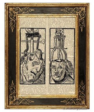 Medieval Brain Surgery Art Print On Vintage Book Page Medical Anatomy Weird Gift