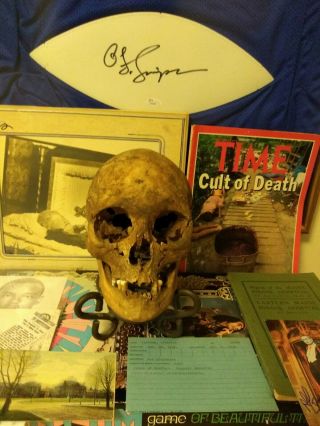 Antique 1800s Young Female Skull England Oddities Medical Anomaly