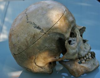 Antique Ancient Historical Medical,  Anatomical Use Human Skull 18 - 19.  C