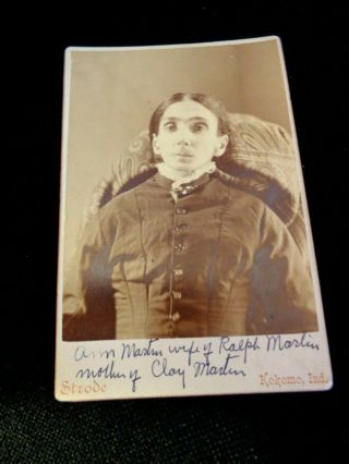 Antique Post Mortem Cdv Photograph Of Lady Scary Opened Eyes