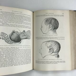 Vintage Medical Book 1924 Principle And Practice Of Obstetrics Delee Illustrated