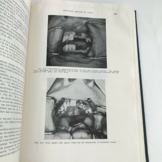 Vintage Medical Book 1952 Oral Surgery Volume 1 Illustrations Graphic Photos