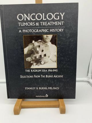 Oncology: Tumors And Treatment - - Medical Photo History Books By Stanley Burns -